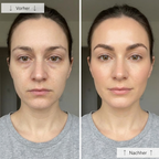 LUNEVA LED Lichttherapie-Maske
